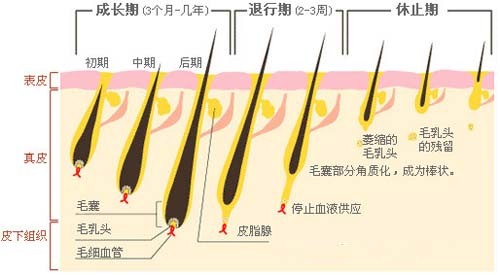 激光脫毛,808半導(dǎo)休脫毛機(jī),永久脫毛,無(wú)痛脫毛