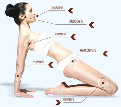 激光脫毛,808半導(dǎo)休脫毛機(jī),永久脫毛,無(wú)痛脫毛
