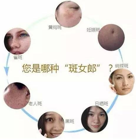 祛斑,祛斑儀器,激光祛斑,點(diǎn)陣祛斑優(yōu)勢
