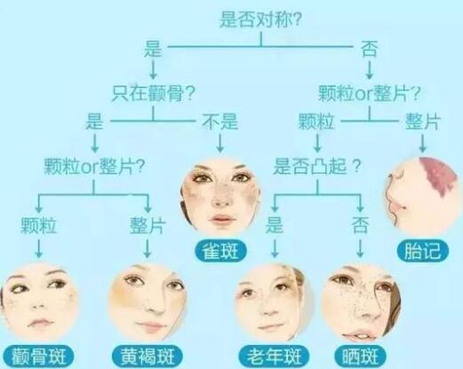 祛斑,祛斑儀器,激光祛斑,點(diǎn)陣祛斑優(yōu)勢
