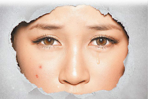 拒當(dāng)「痘花妹」！看痘痘生長(zhǎng)的位置判斷也許是身體出了問(wèn)題