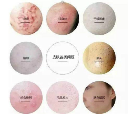 你知道補水對皮膚到底有多重要嗎？