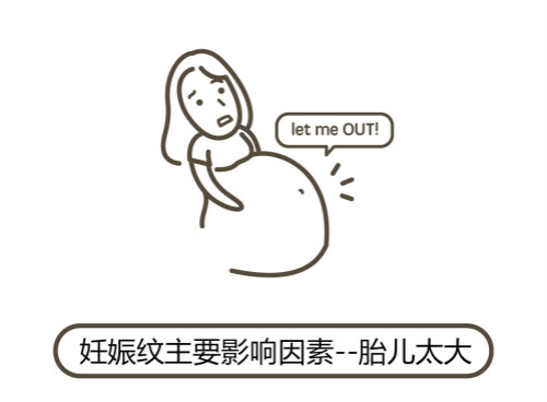 一文秒懂！妊娠紋肥胖紋保養(yǎng)、治療及預(yù)防全攻略