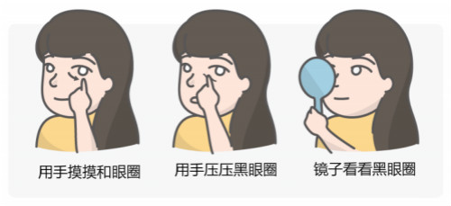 區(qū)分黑眼圈！黑眼圈的成因、分類(lèi)、預(yù)防與治療全攻略
