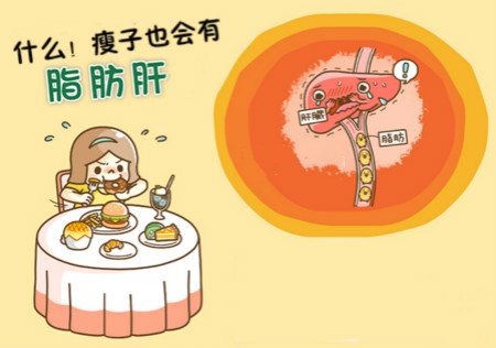 什么！瘦子也會有「脂肪肝」？