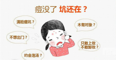 激光去痘印方法你適合嗎？
