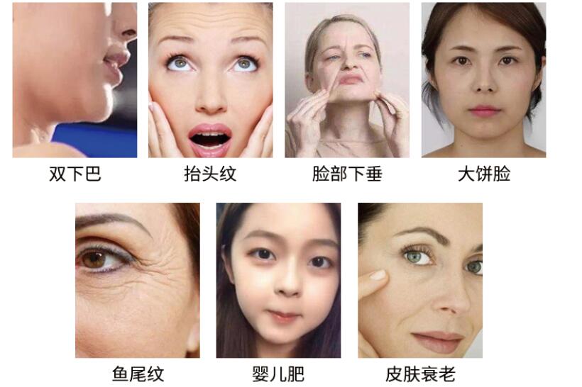 美容儀廠家教您怎么預(yù)防臉上長斑，要注意什么?
